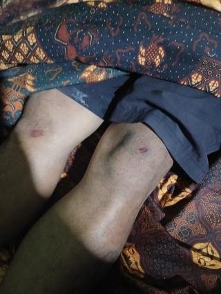 Sopir PT CR Tewas saat Cuci Truk di Areal IKPP 